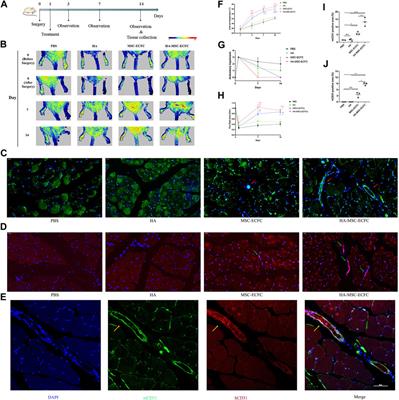 Hyaluronic Acid Facilitates Angiogenesis of Endothelial Colony Forming Cell Combining With Mesenchymal Stem Cell via CD44/ MicroRNA-139-5p Pathway